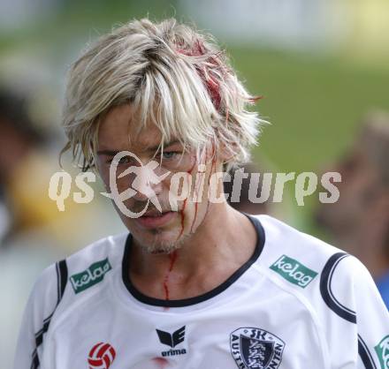 Fussball Testspiel. SK Austria Kaernten gegen Steaua Bukarest. Gerhard Breitenberger mit Cut nach Zusammenstoss (Kaernten), (Bukarest). Feldkirchen, am 2.7.2008.
Copyright: Kuess


---
pressefotos, pressefotografie, kuess, qs, qspictures, sport, bild, bilder, bilddatenbank